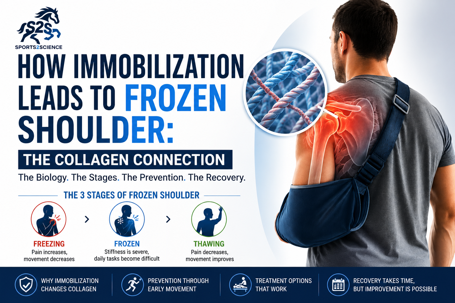 How Immobilization Leads to Frozen Shoulder: The Collagen Connection